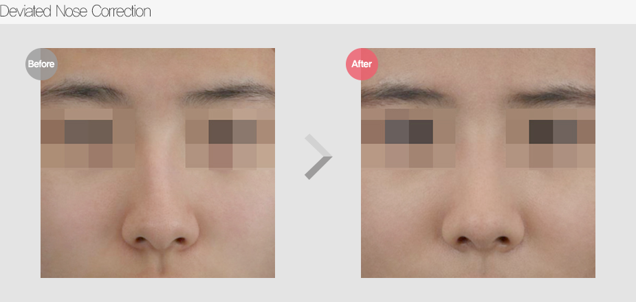 Before & After Pictures