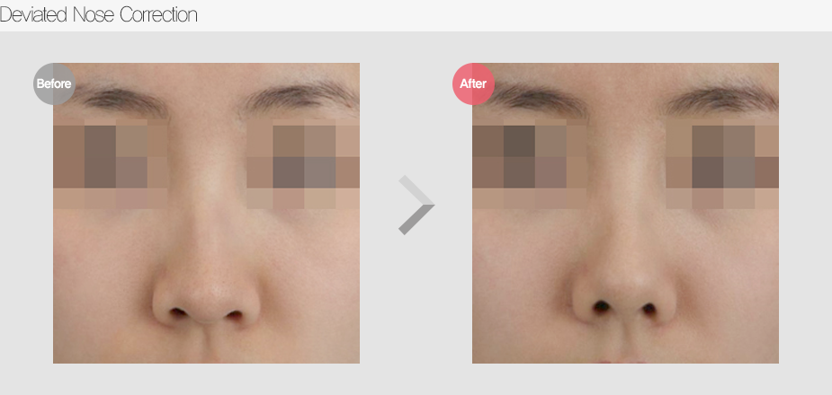 Before & After Pictures